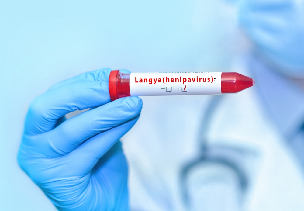 Langya, ce nouveau virus apparu à Taïwan